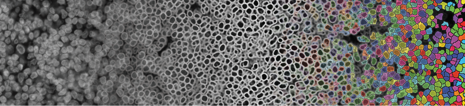 Visualization of raw image of cells being segmented into single cells from left to right